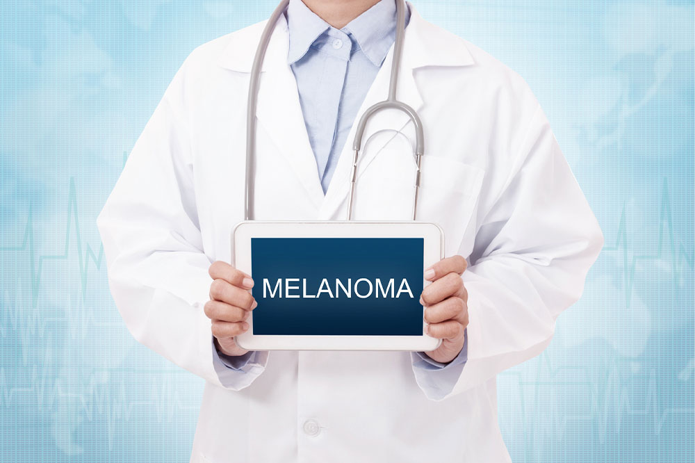 3 effective tips for dealing with melanoma